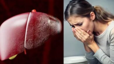 Photo of त्वचा पर नजर आते हैं लिवर की खराबी के 5 लक्षण